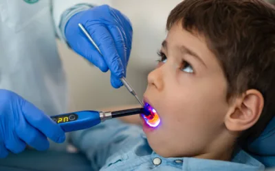 Can a Cavity in a Baby Tooth Cause Pain or Infection?